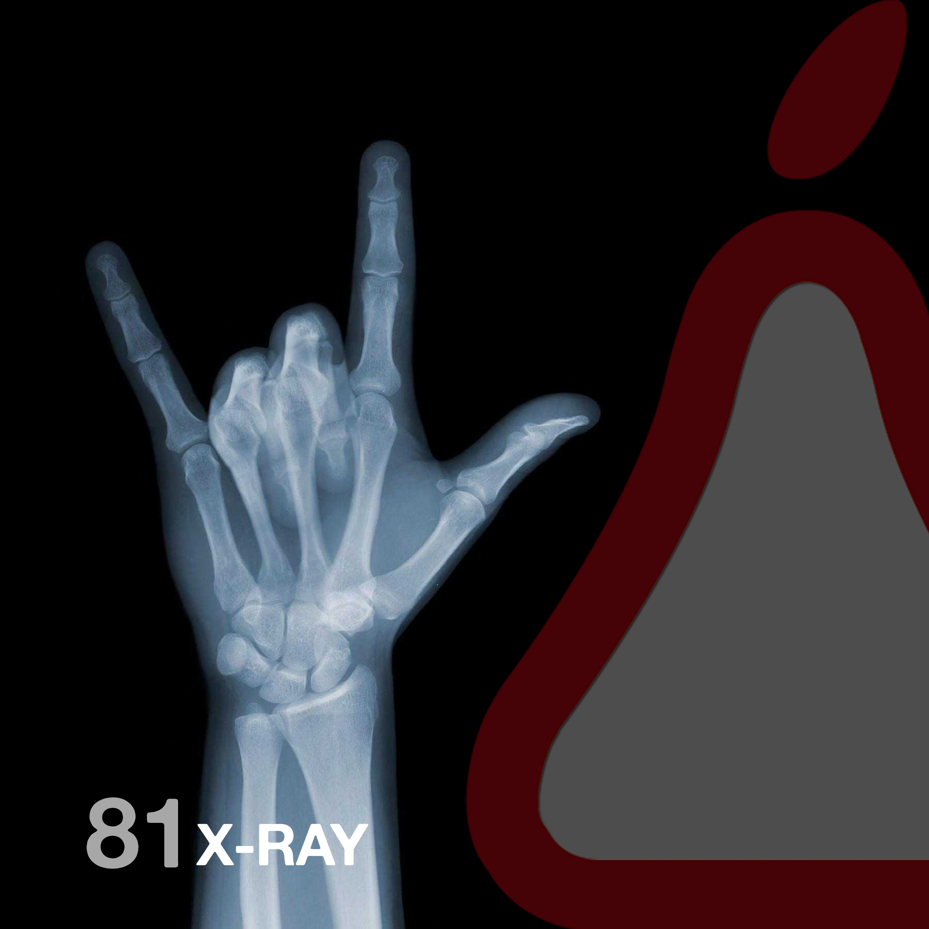 X-Ray