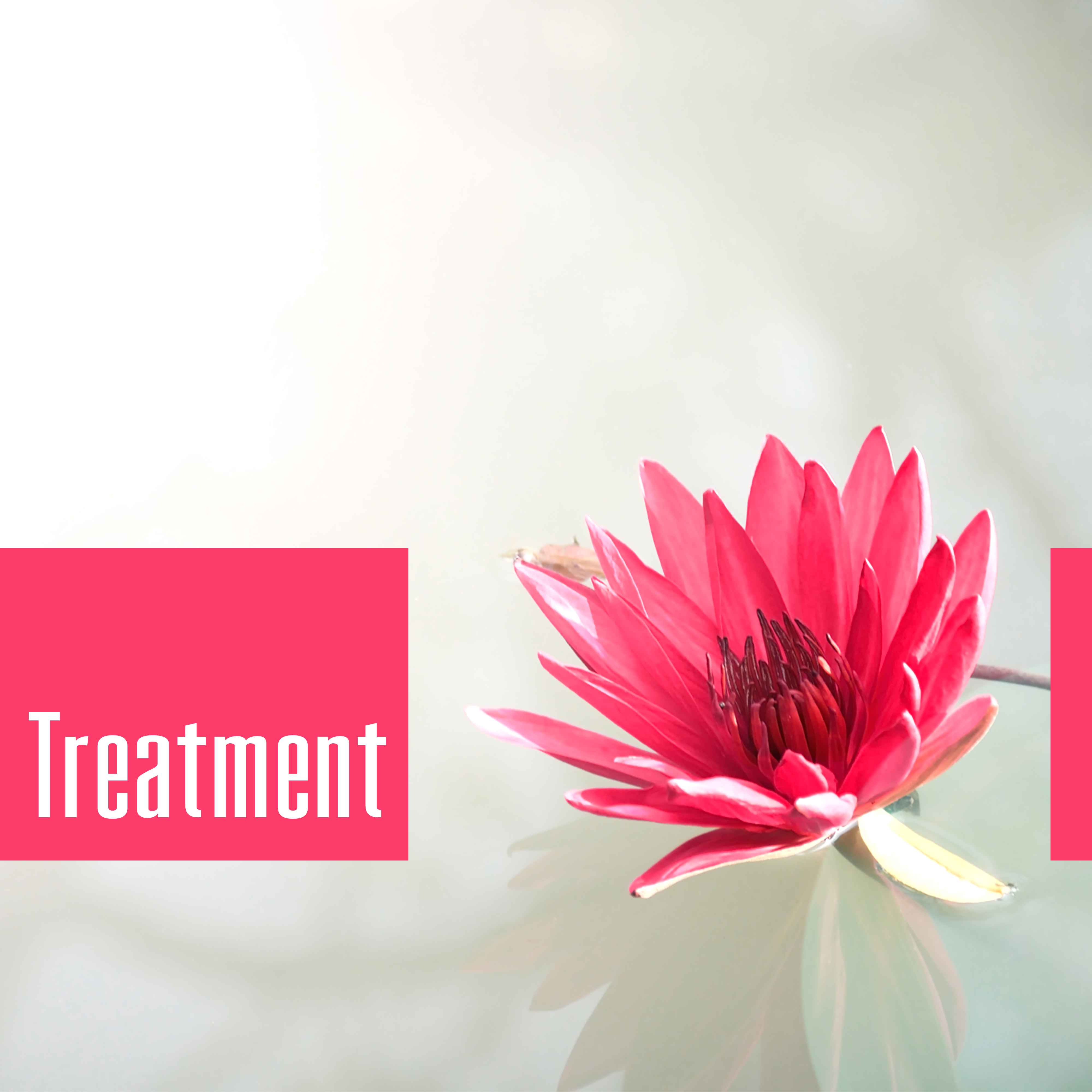 Treatment – Recreation, Rest, Relaxation, Still, Calm, Sweet Idleness, Pleasant Time