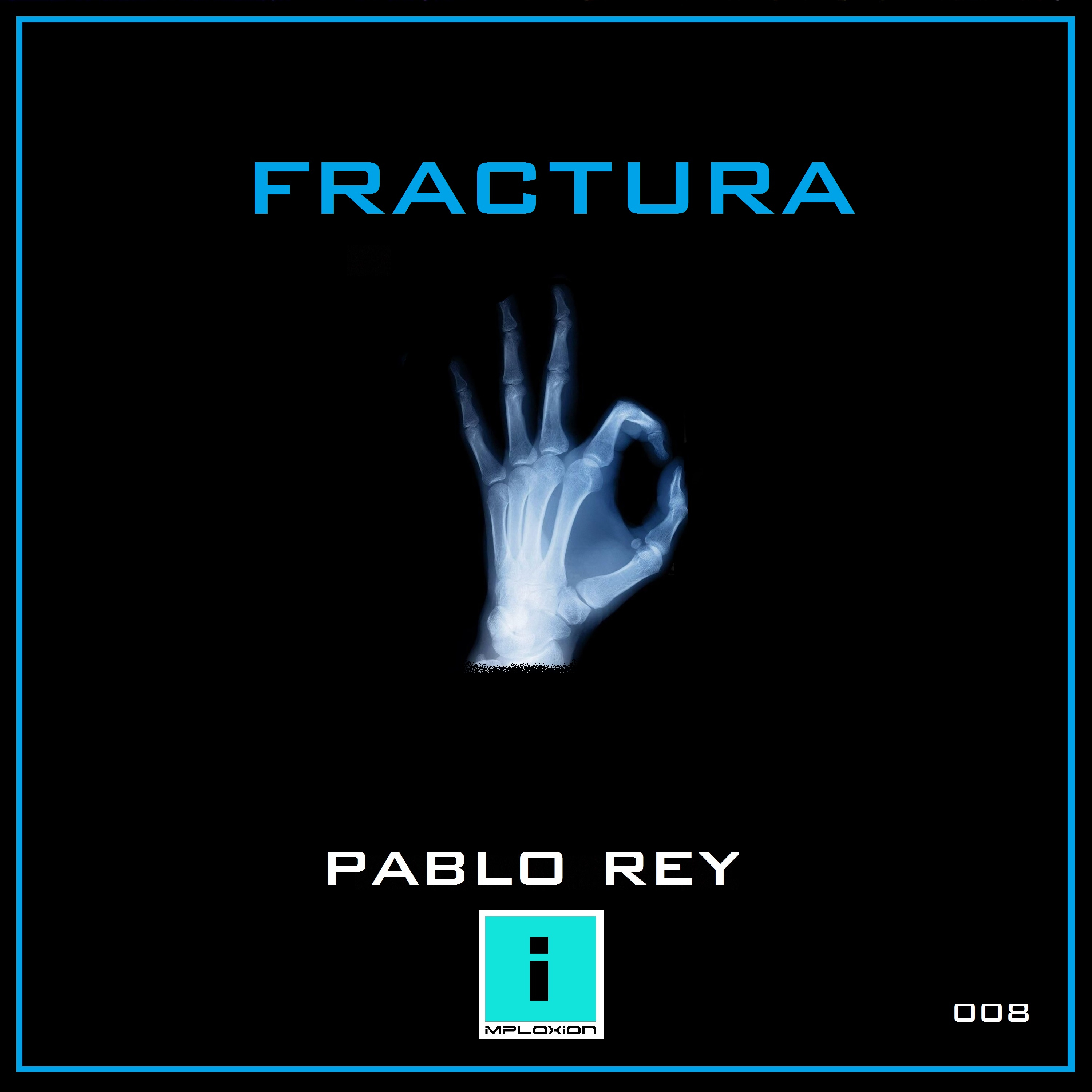 FRACTURA