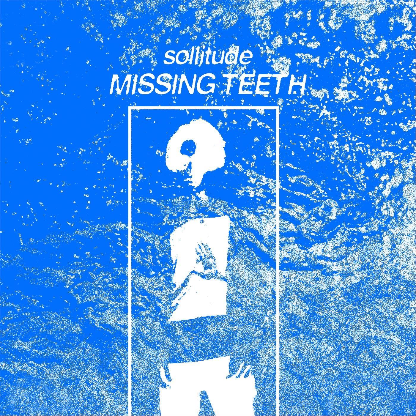 Missing Teeth