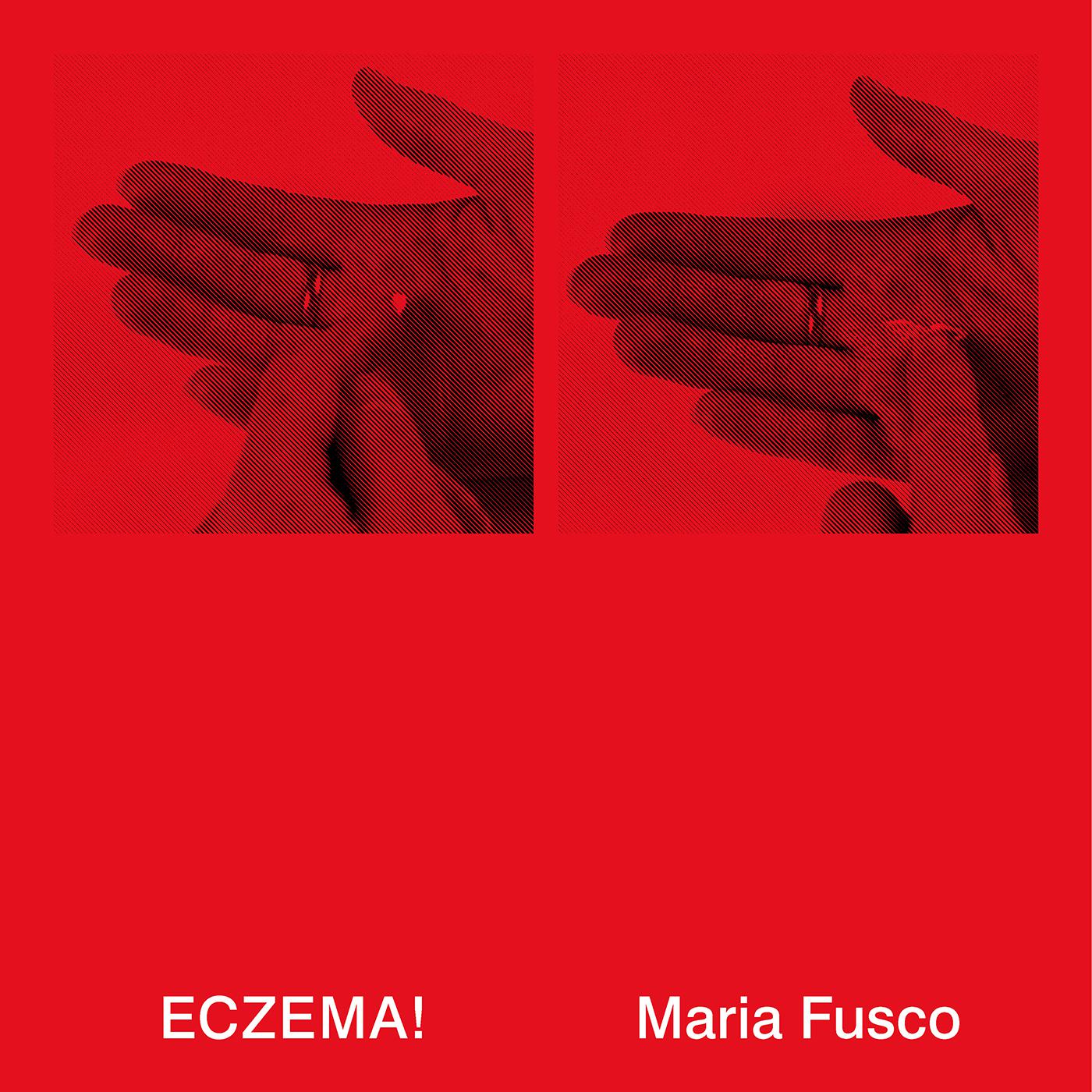 ECZEMA! - Live