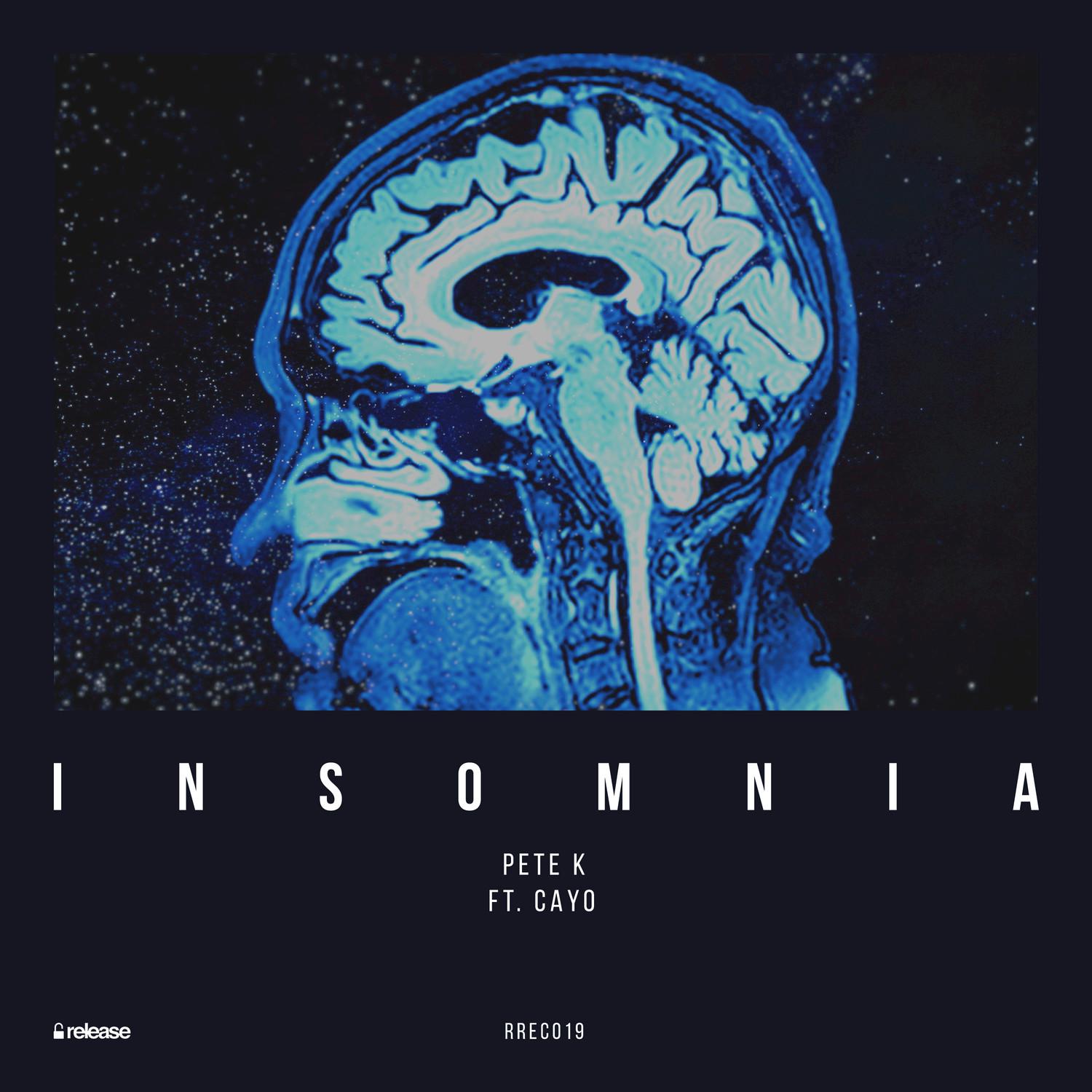 Insomnia (Radio Edit)